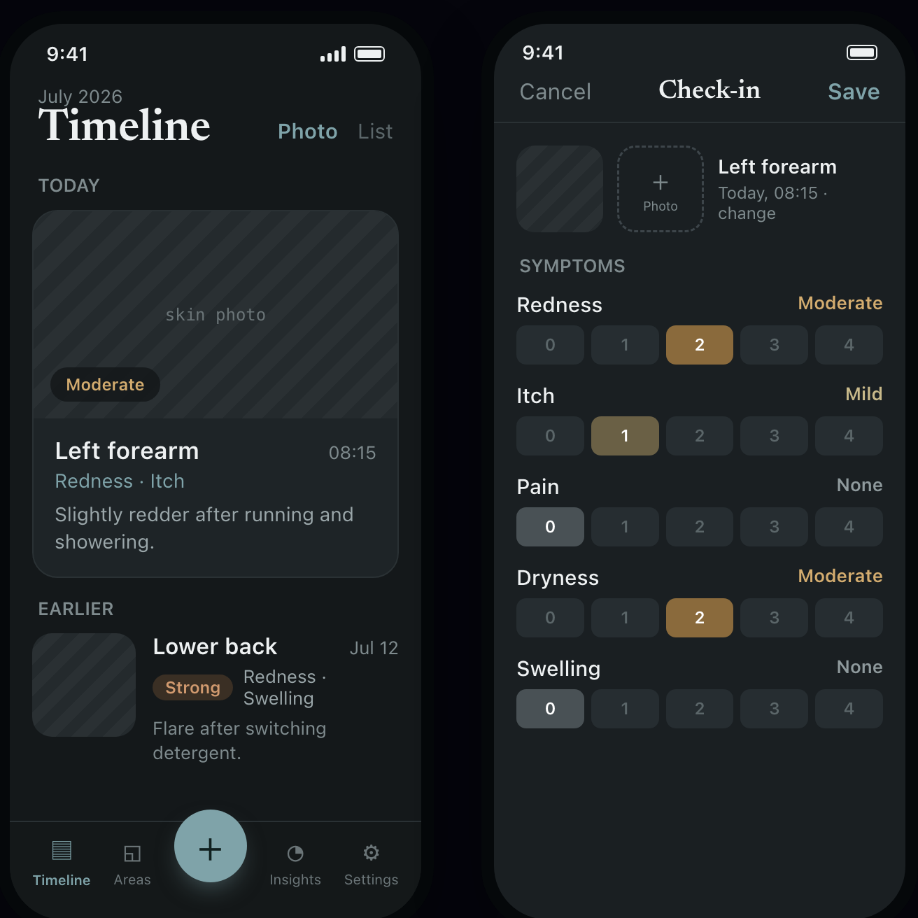 SkinTimeline on iPhone — the timeline of recorded skin areas beside a check-in rating redness, itch, pain, dryness and swelling